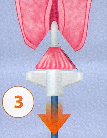 6a5e104d0012c9bc2bc2 - Image 4